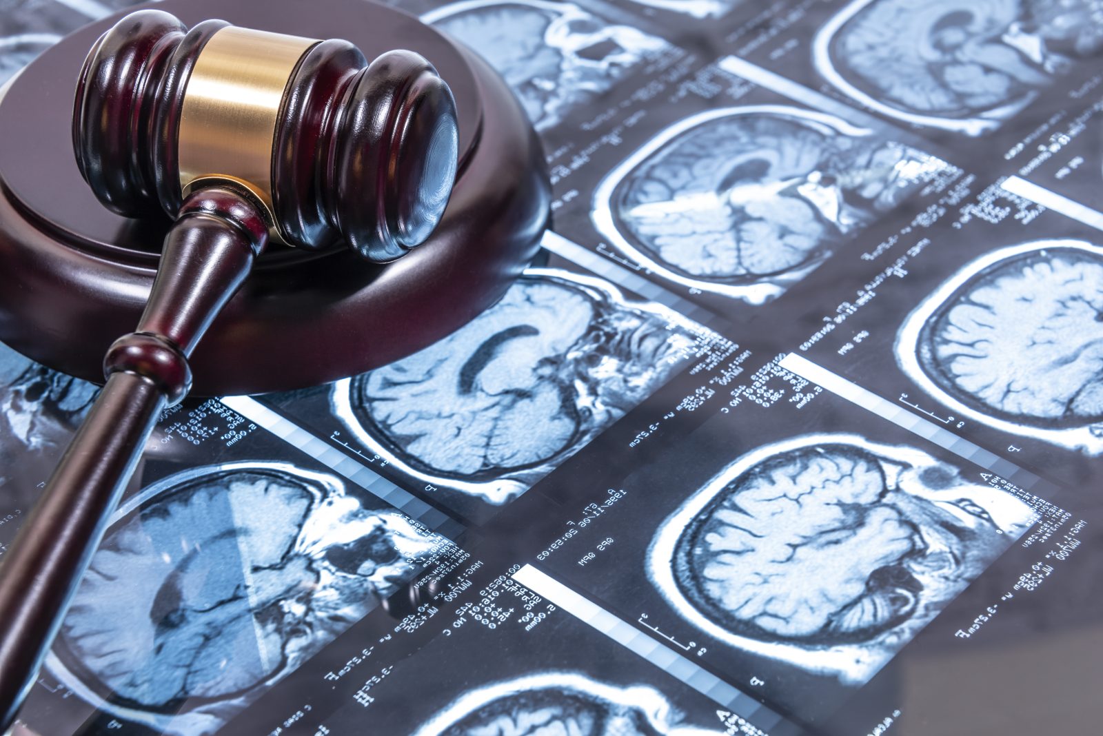Proving liability in Odessa head injury cases