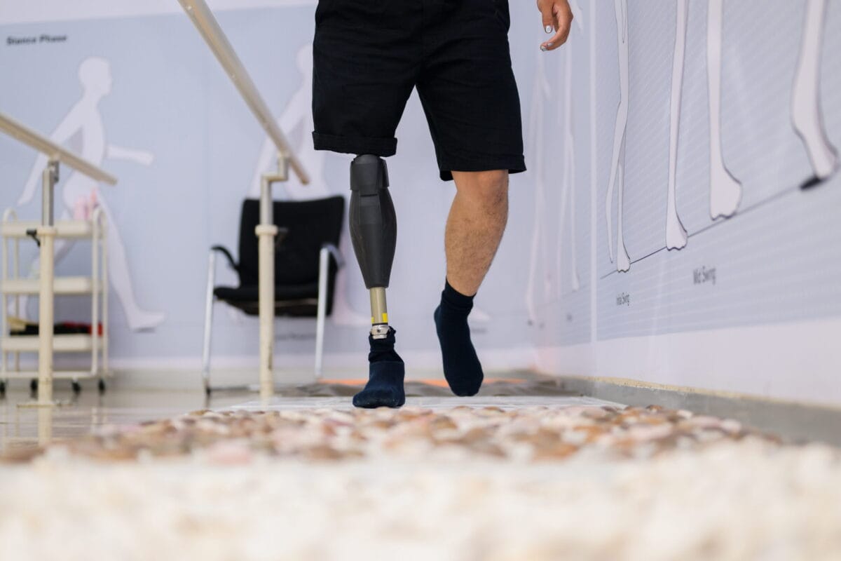 A person with a prosthetic leg walks in a rehabilitation facility.